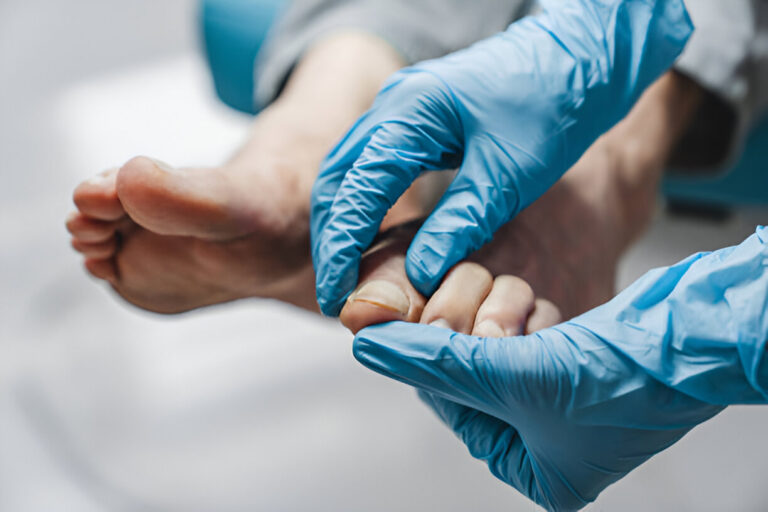 What works fastest for Toenail Fungus?