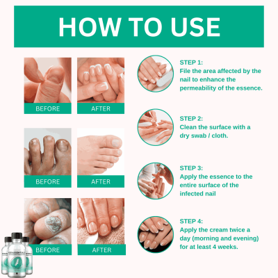 How to cure nail fungus